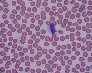 红细胞(图1)