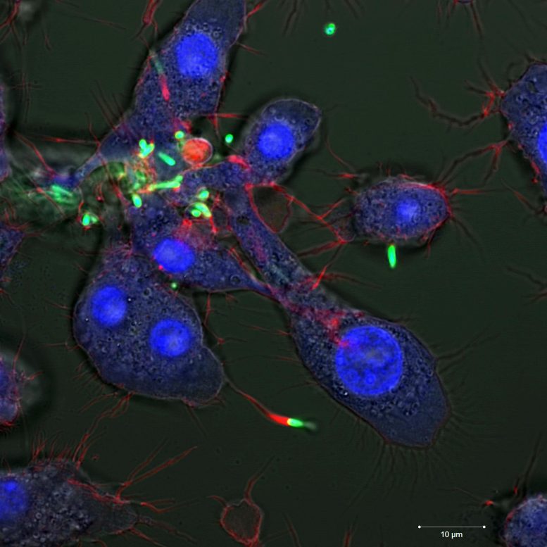 研究人员使用纳米粒子杀死隐藏在人体细胞内的危险细菌(图1)