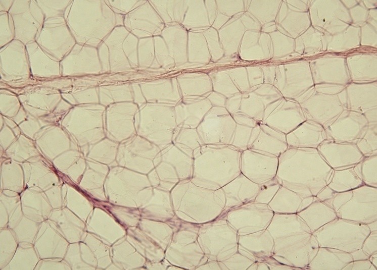脂肪细胞(图1)