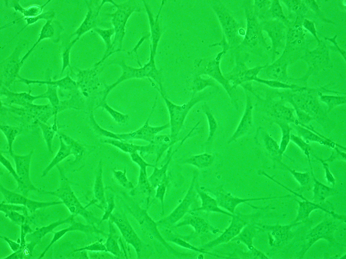 成纤维细胞(图1)