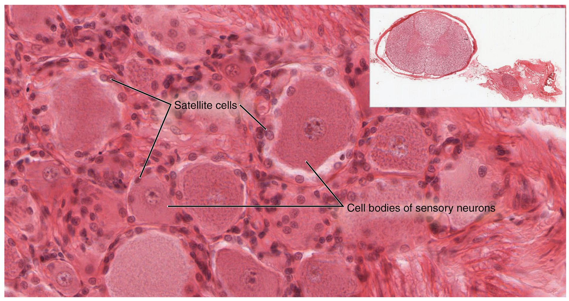 卫星细胞_卫星胶质细胞(图1)
