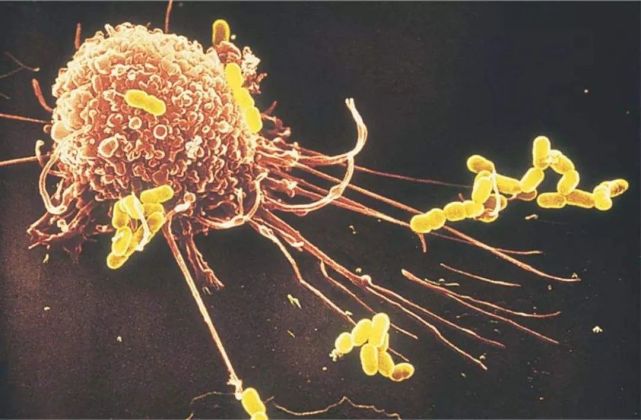 自然杀伤NK细胞丨人体免疫的广谱杀手，防癌、抵御病毒、抗衰老一肩挑(图9)