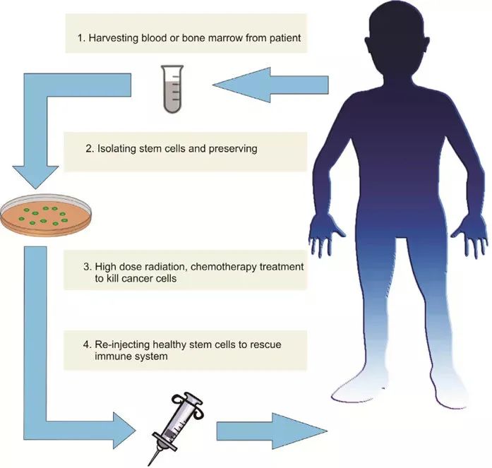 干细胞是怎样被用于治疗骨癌的？(图2)