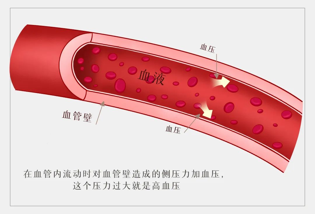干细胞治疗高血压的三大原则(图2)
