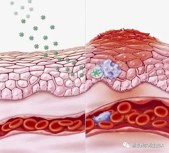 医学专刊 | 干细胞：缓解慢性炎症的新希望！(图1)