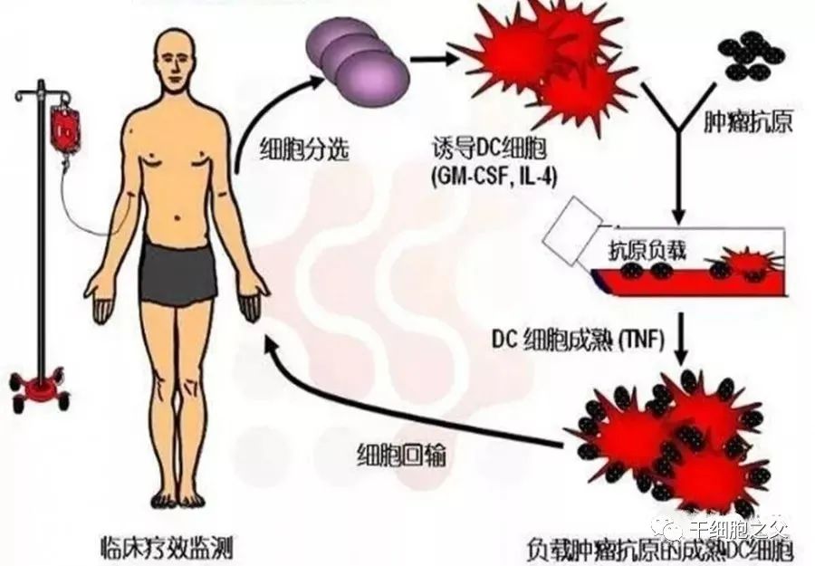 挑战癌王！诺奖得主斯坦曼“以身试药”，树突状细胞疗法将他生存期延长4年半(图4)