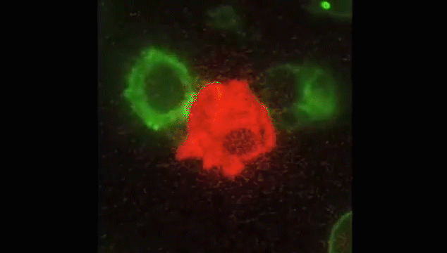 NK免疫细胞：人体内强大抗癌先锋(图1)
