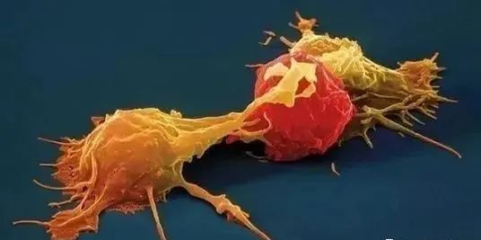 抗癌“新星”—NK细胞疗法的临床研究新进展(图1)