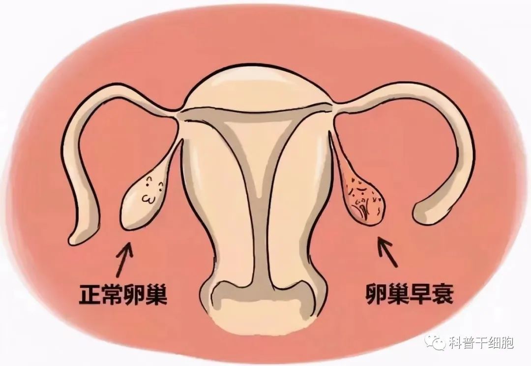 逆转更年期！干细胞解决卵巢早衰和提前闭经问题(图2)