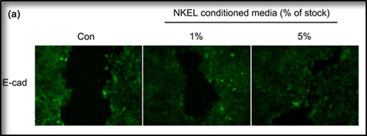 新研究发现：NK免疫细胞能改善皮肤皱纹并防止衰老(图5)