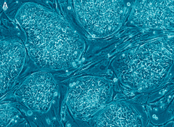干细胞(图1)