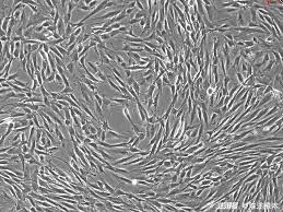 纤维细胞(图1)